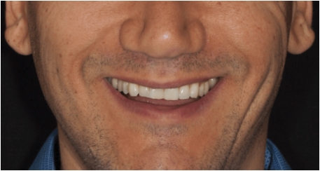 g5-img-before