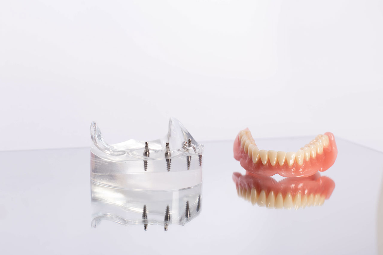 prosthesis