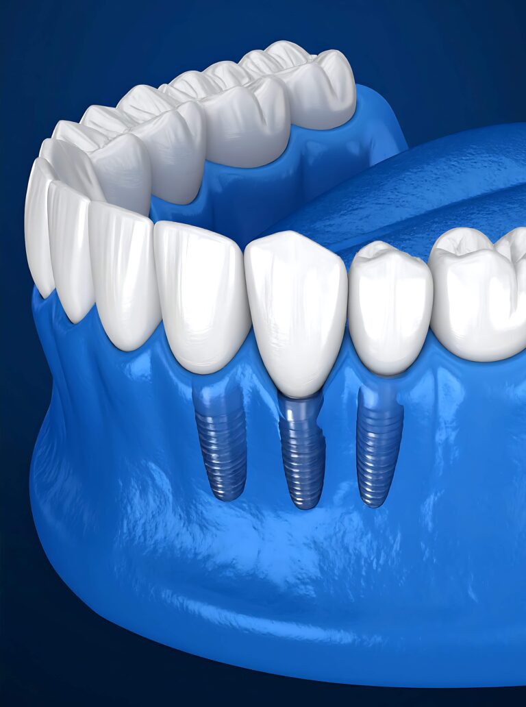 AdobeStock 1611227963 1 e1756646158362 - Seattle Dental Studio