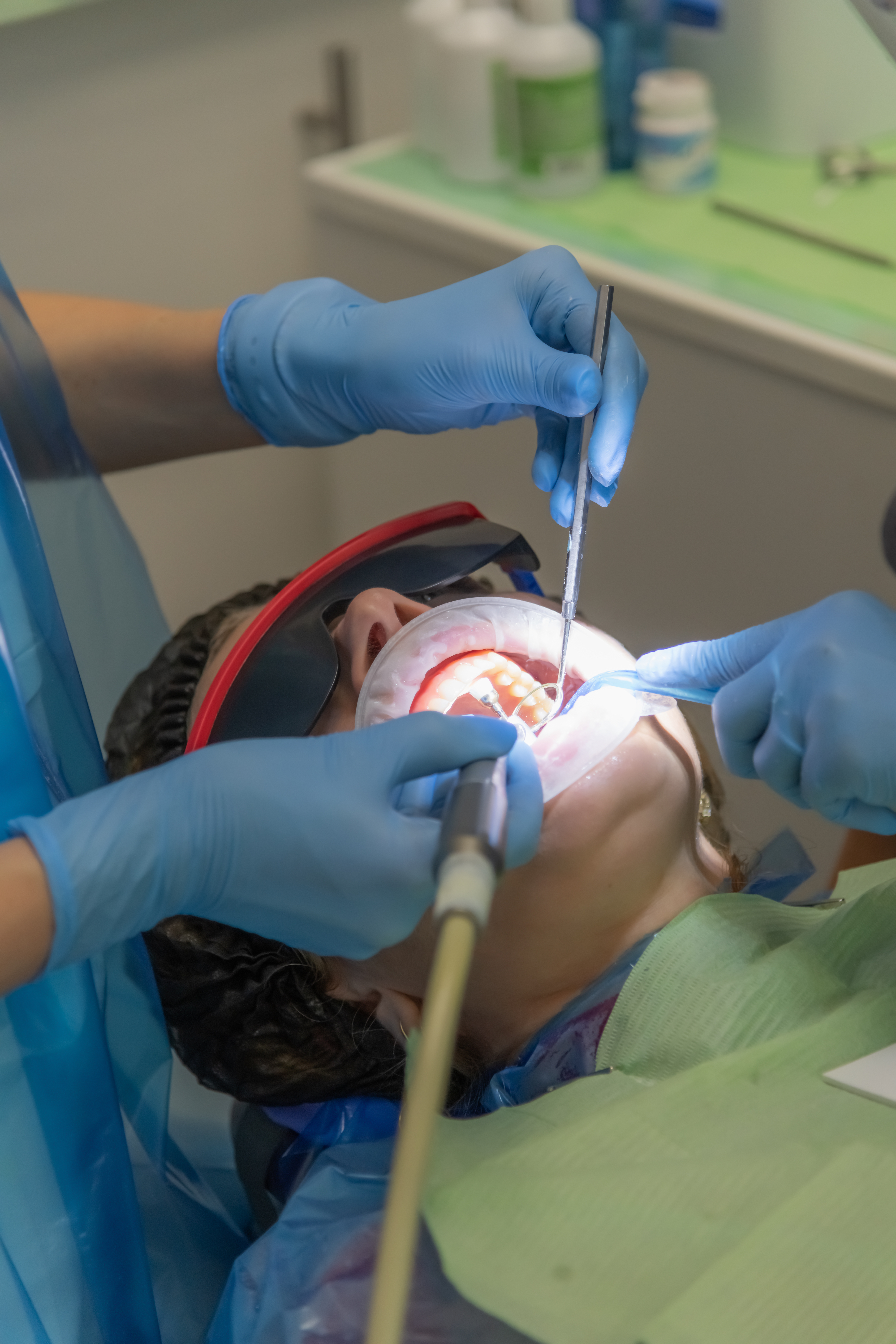 AdobeStock 1533935845 - Seattle Dental Studio