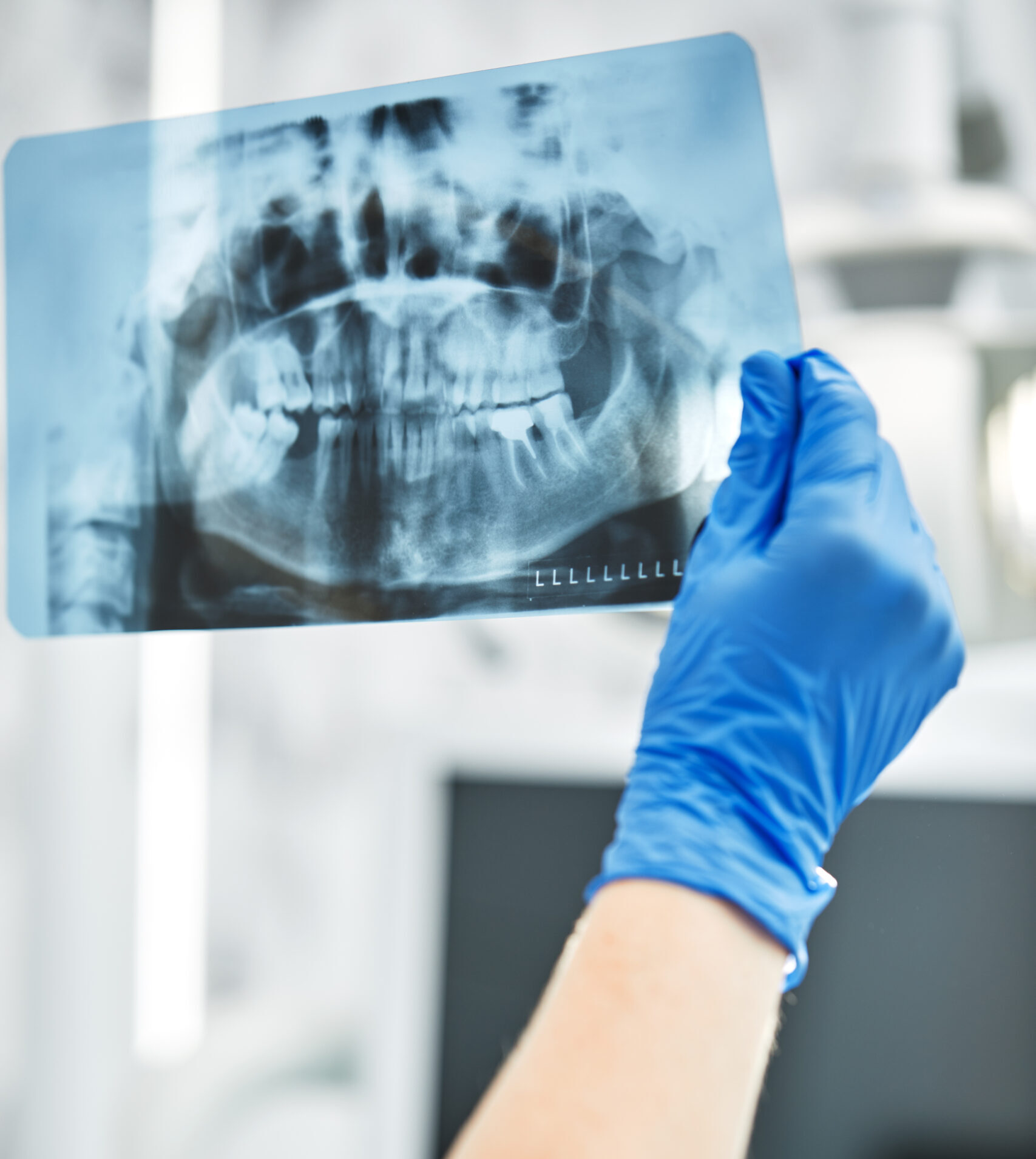 AdobeStock 404848871 scaled e1759850424636 - Seattle Dental Studio